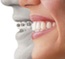 image_Invisalign