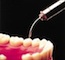 image_Laser Dentistry